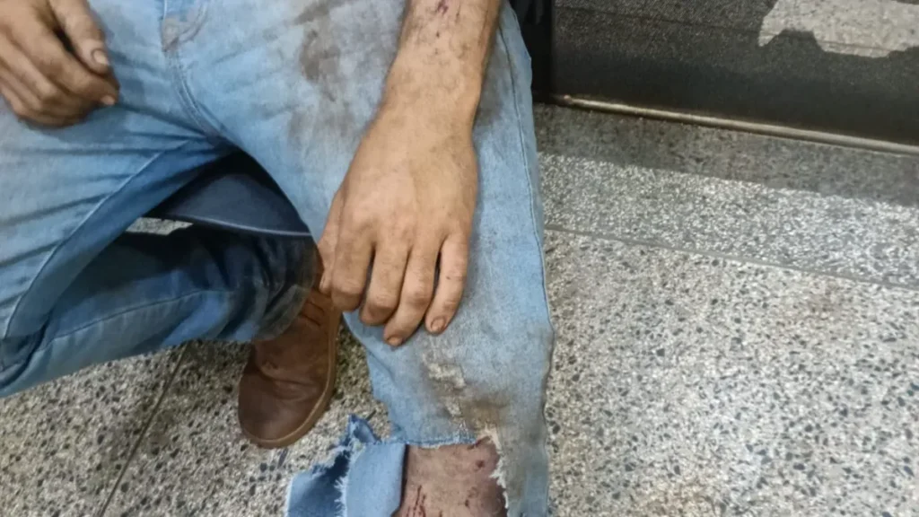 Jovem é atacado por suposta onça em colheitadeira em MS
